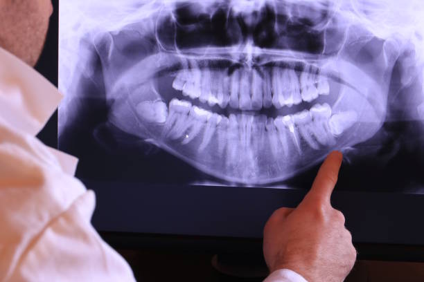 Best Dentist for Tooth Abscess  in Wareham Center, MA